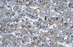 LHX6 Antibody in Immunohistochemistry (Paraffin) (IHC (P))