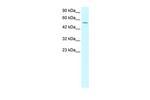 LHX6 Antibody in Western Blot (WB)