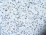 HIPK2 Antibody in Immunohistochemistry (Paraffin) (IHC (P))