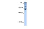 HIPK2 Antibody in Western Blot (WB)