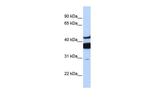 Lass2 Antibody in Western Blot (WB)