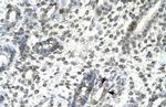 T-bet Antibody in Immunohistochemistry (IHC)