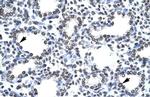 CITED1 Antibody in Immunohistochemistry (IHC)