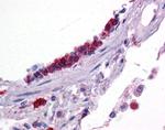 KLF2 Antibody in Immunohistochemistry (IHC)