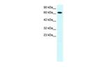 PIAS3 Antibody in Western Blot (WB)