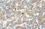 ACAT2 Antibody in Immunohistochemistry (IHC)