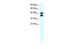 ACAT2 Antibody in Western Blot (WB)