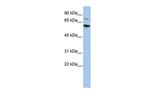 ME1 Antibody in Western Blot (WB)