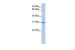 DLX1 Antibody in Western Blot (WB)