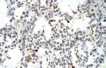 DLX5 Antibody in Immunohistochemistry (IHC)