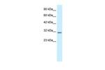 BarX1 Antibody in Western Blot (WB)