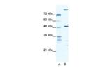 NFS1 Antibody in Western Blot (WB)