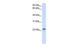 RAB18 Antibody in Western Blot (WB)