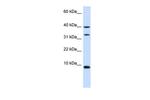 Diazepam Binding Inhibitor Antibody in Western Blot (WB)