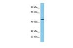 TBX20 Antibody in Western Blot (WB)