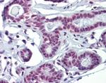 SOX4 Antibody in Immunohistochemistry (IHC)