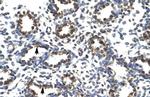 PRDM14 Antibody in Immunohistochemistry (IHC)