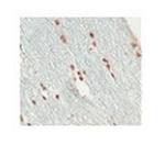 SOX10 Antibody in Immunohistochemistry (Paraffin) (IHC (P))