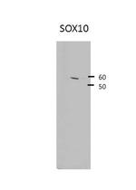 SOX10 Antibody in Western Blot (WB)