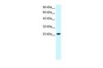 MEAF6 Antibody in Western Blot (WB)