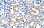 TBX1 Antibody in Immunohistochemistry (IHC)