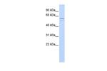 TUB Antibody in Western Blot (WB)