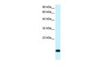 RPS16 Antibody in Western Blot (WB)