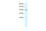 LHX3 Antibody in Western Blot (WB)