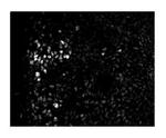 ZEB2 Antibody in Immunohistochemistry (IHC)