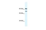 ZEB2 Antibody in Western Blot (WB)