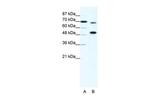 MLL4 Antibody in Western Blot (WB)