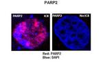 PARP2 Antibody in Immunocytochemistry (ICC/IF)