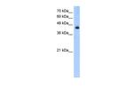 ACADL Antibody in Western Blot (WB)