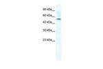 SMPDL3B Antibody in Western Blot (WB)