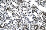 PTHLH Antibody in Immunohistochemistry (Paraffin) (IHC (P))