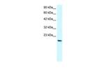 PTHLH Antibody in Western Blot (WB)