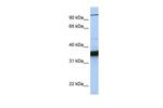 KIFC3 Antibody in Western Blot (WB)