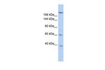 KIF13B Antibody in Western Blot (WB)