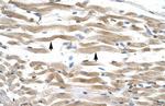 KIFC2 Antibody in Immunohistochemistry (IHC)