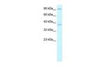 KIFC2 Antibody in Western Blot (WB)