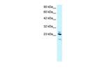 RGS20 Antibody in Western Blot (WB)