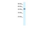 RCOR3 Antibody in Western Blot (WB)