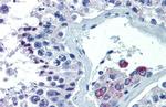 ASH2L Antibody in Immunohistochemistry (IHC)