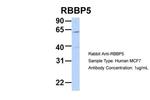 RBBP5 Antibody in Western Blot (WB)