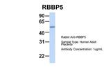 RBBP5 Antibody in Western Blot (WB)