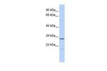 MED6 Antibody in Western Blot (WB)