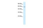 TCP-1 delta Antibody in Western Blot (WB)