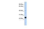 GTL3 Antibody in Western Blot (WB)