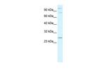 RNF3 Antibody in Western Blot (WB)