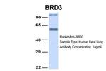 BRD3 Antibody in Western Blot (WB)